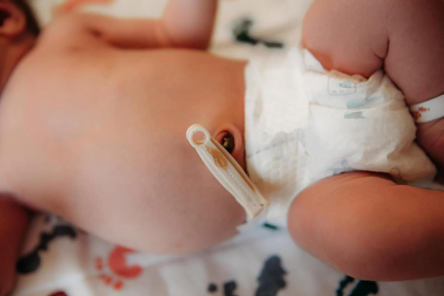 Newborn baby receiving gentle care